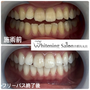 【メンテナンスも大切です！！】