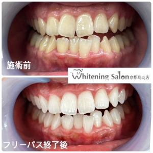 【コンプレックス解消】